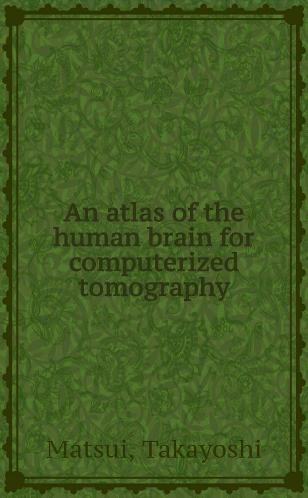 An atlas of the human brain for computerized tomography