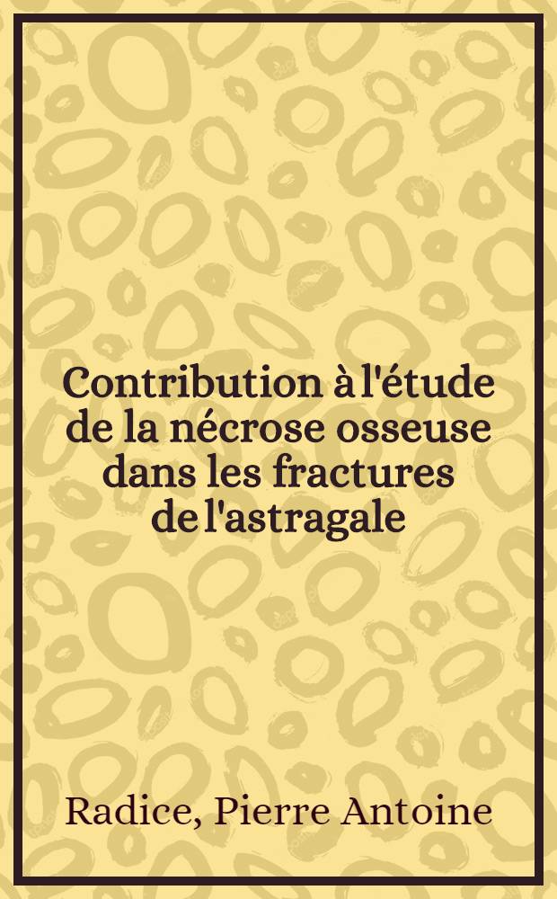 Contribution &agrave; l'&eacute;tude de la n&eacute;crose osseuse dans les fractures de l'astragale : &Agrave; propos de 9 observations : Proposition d'une technique de greffe p&eacute;dicul&eacute;e &agrave; vis&eacute;e curative et surtout pr&eacute;ventive : Th&egrave;se ..