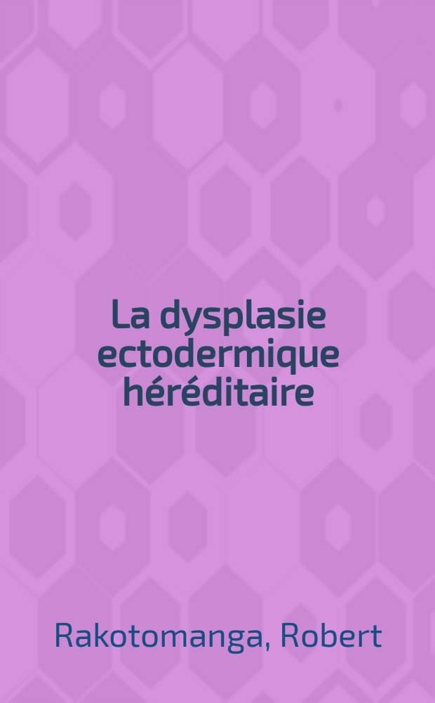 La dysplasie ectodermique héréditaire : (Syndrome anhydrose avec hypotrichose et anodontie) : Revue générale à propos d'un cas récent : Thèse ..