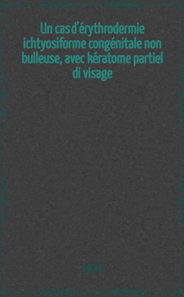 Un cas d'érythrodermie ichtyosiforme congénitale non bulleuse, avec kératome partiel di visage : Thèse ..