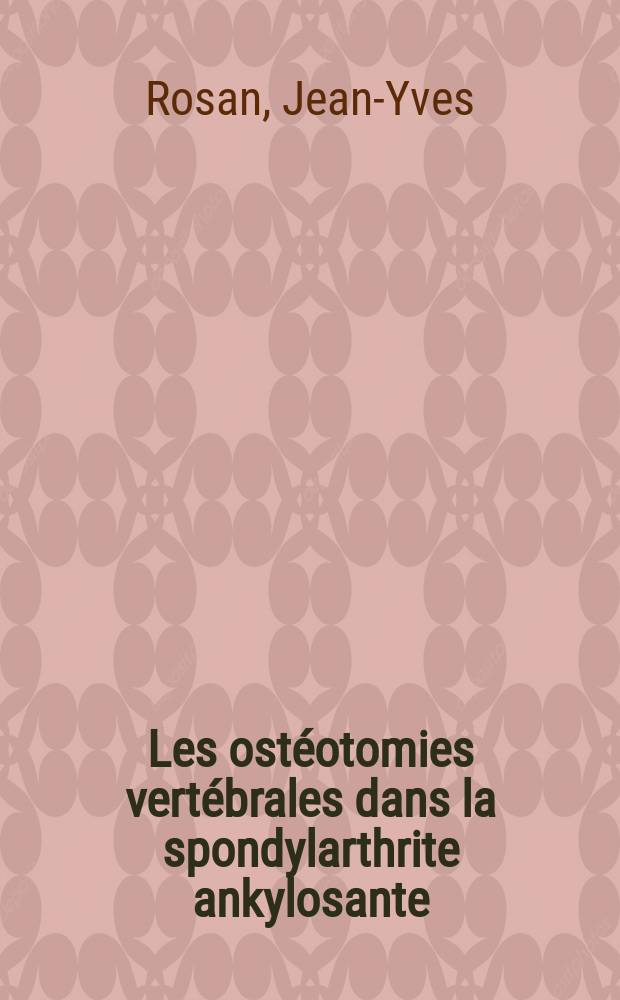 Les ost&eacute;otomies vert&eacute;brales dans la spondylarthrite ankylosante : &Agrave; propos d'une observation personnelle : Th&egrave;se ..