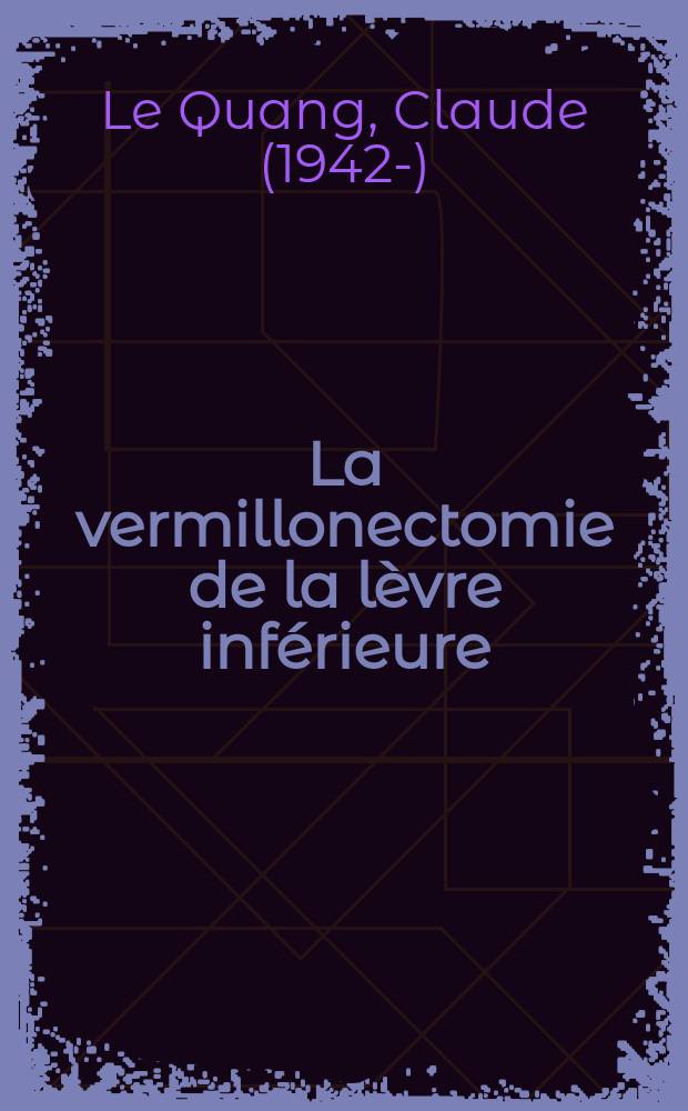 La vermillonectomie de la lèvre inférieure : Thèse ..