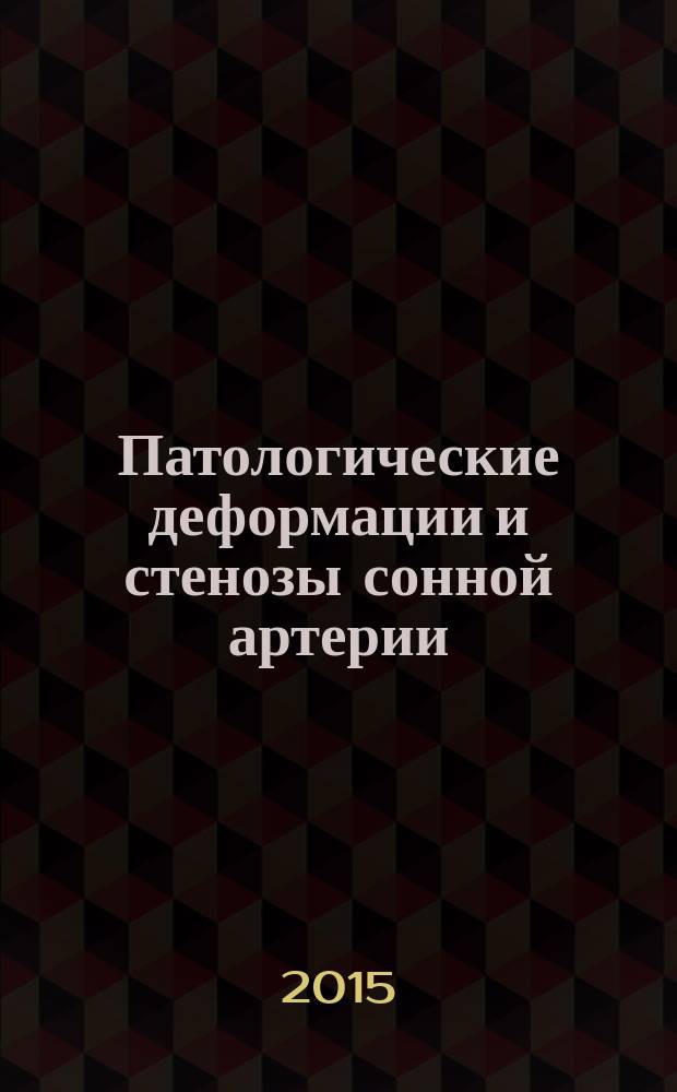 Патологические деформации и стенозы сонной артерии