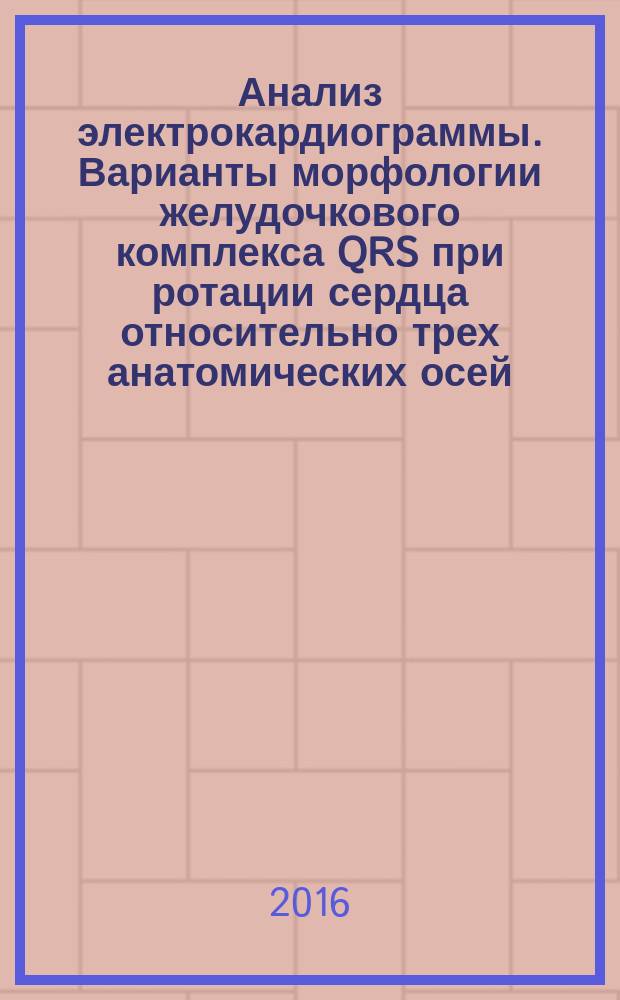 Анализ электрокардиограммы. Варианты морфологии желудочкового комплекса QRS при ротации сердца относительно трех анатомических осей : учебное пособие